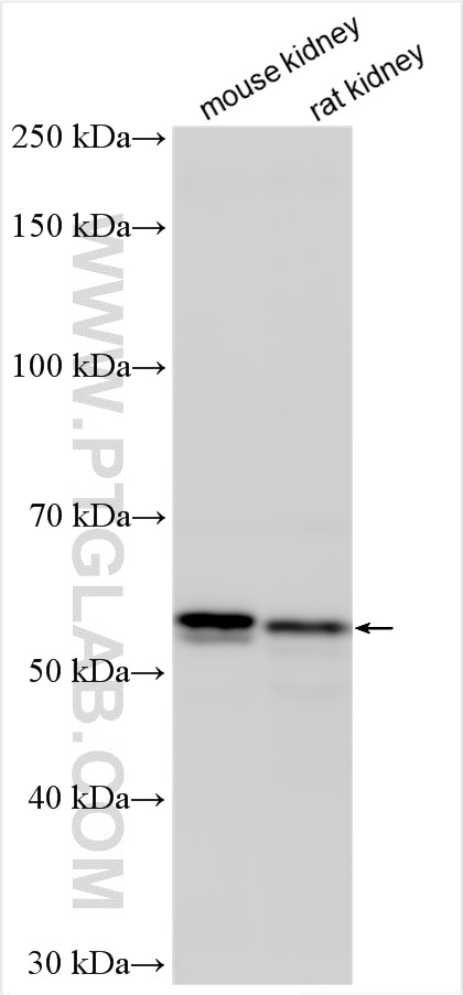 Western Blot (WB) analysis of various lysates using ACSM3 Polyclonal antibody (10168-2-AP)