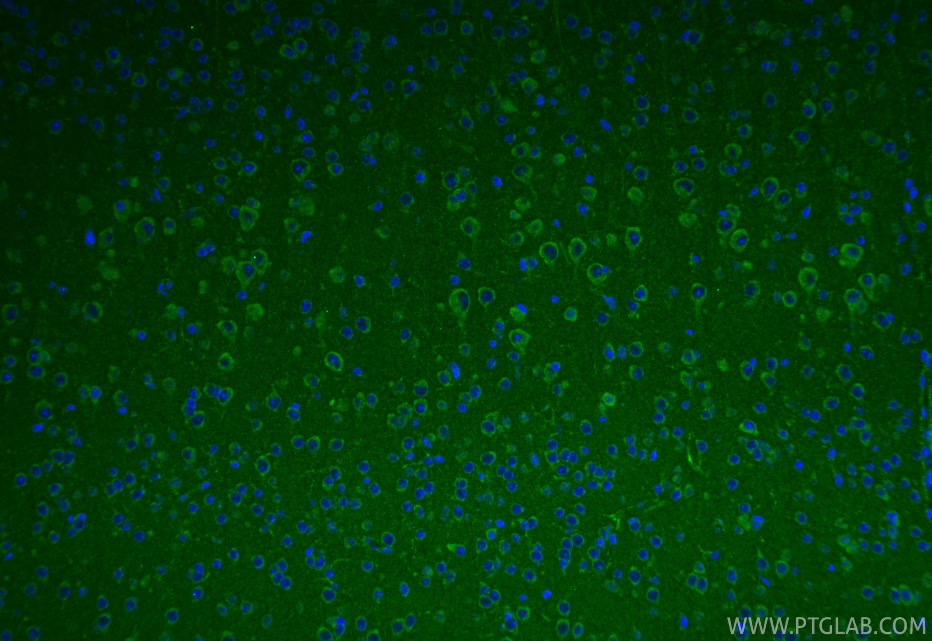 IF Staining of mouse brain using 16591-1-AP Immunofluorescence (IF) / fluorescent staining of mouse brain tissue using ACSM5 Polyclonal antibody (16591-1-AP)