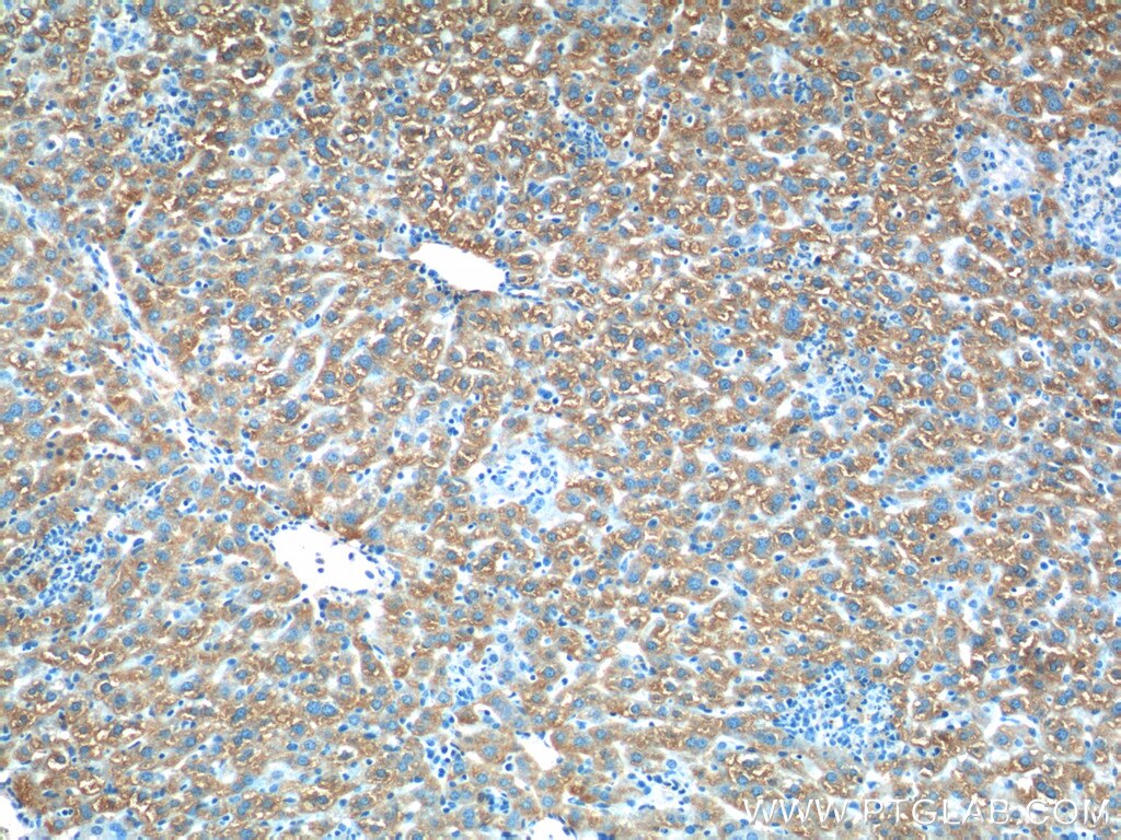 Immunohistochemistry (IHC) staining of mouse liver tissue using ACSM5 Polyclonal antibody (16591-1-AP)