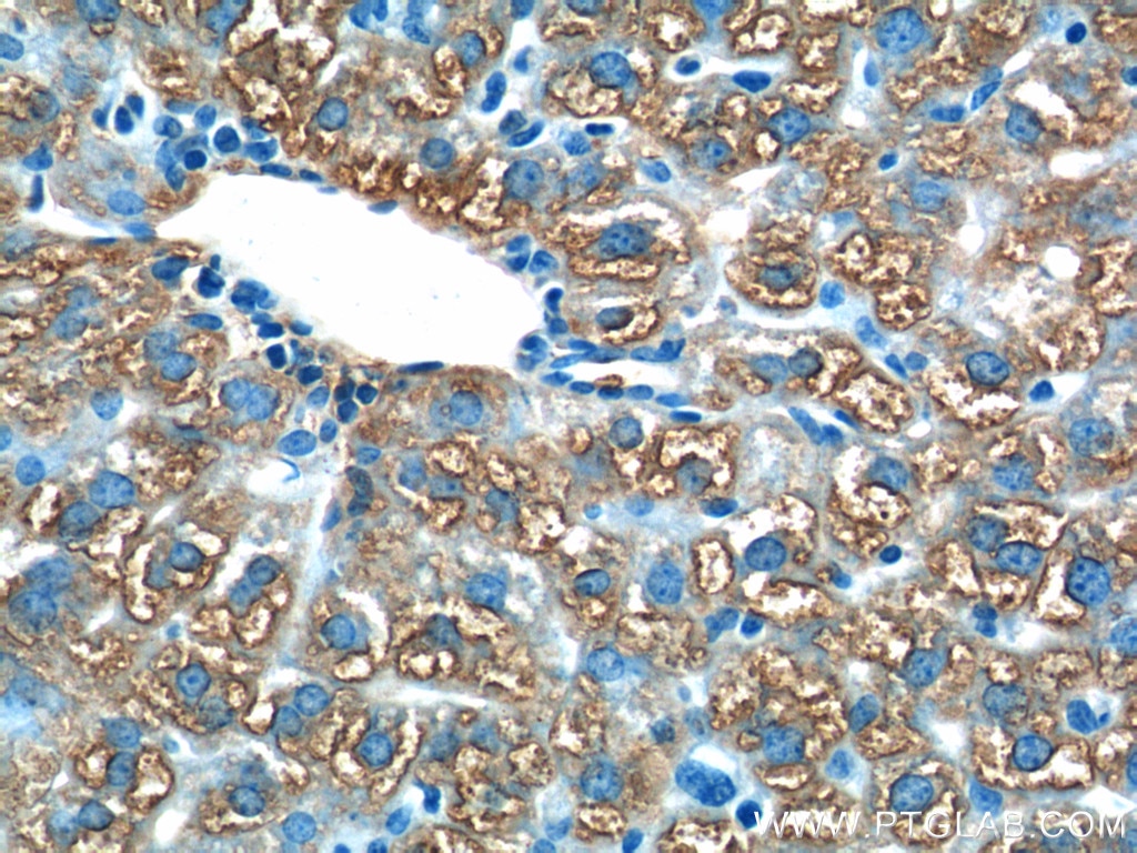 Immunohistochemistry (IHC) staining of mouse liver tissue using ACSM5 Polyclonal antibody (16591-1-AP)