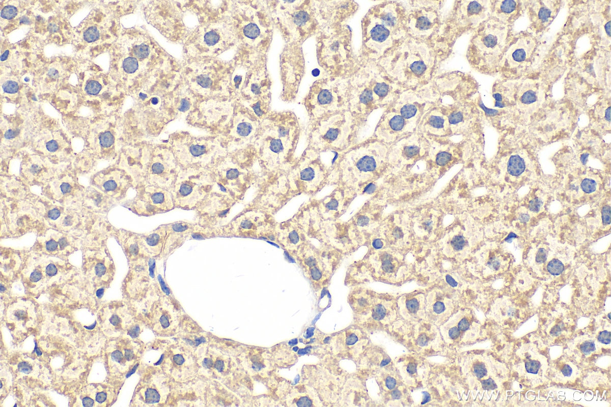 Immunohistochemistry (IHC) staining of mouse liver tissue using ACSM5 Polyclonal antibody (16591-1-AP)