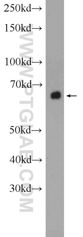 Western Blot (WB) analysis of mouse liver tissue using ACSM5 Polyclonal antibody (16591-1-AP)