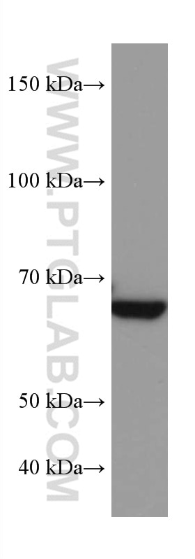 Western Blot (WB) analysis of 4T1 cells using ACSM5 Monoclonal antibody (67334-1-Ig)