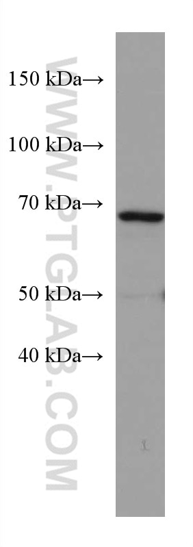 Western Blot (WB) analysis of MDA-MB-231 cells using ACSM5 Monoclonal antibody (67334-1-Ig)