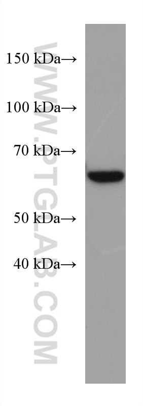 WB analysis of 4T1 using 67334-1-Ig