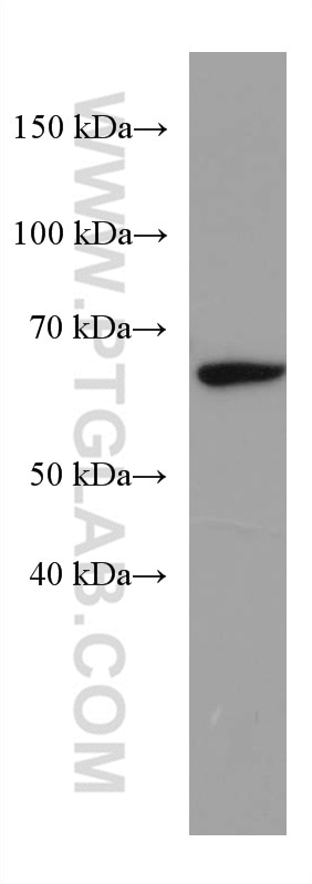 Western Blot (WB) analysis of rat liver tissue using ACSM5 Monoclonal antibody (67334-1-Ig)