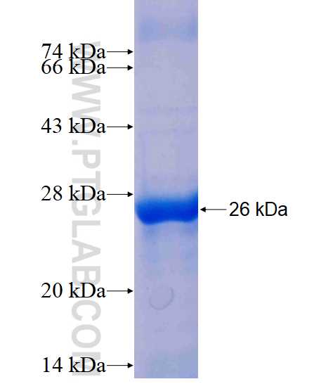 ACSM5 fusion protein Ag10056 SDS-PAGE