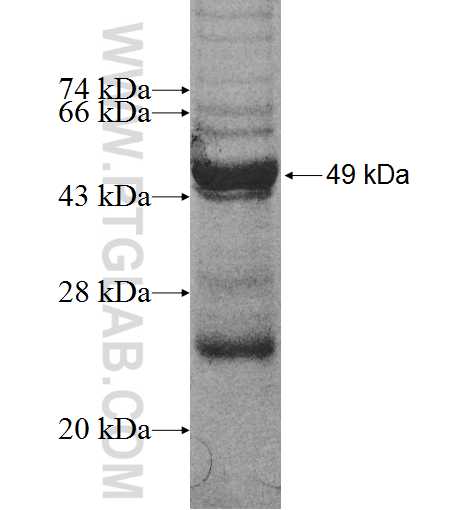 ACSM5 fusion protein Ag9373 SDS-PAGE