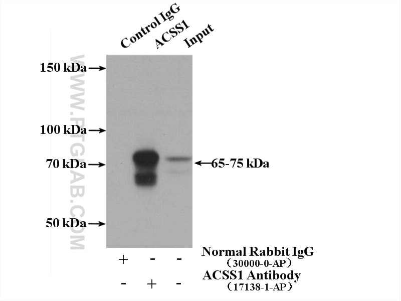 Immunoprecipitation (IP) experiment of mouse kidney tissue using ACSS1 Polyclonal antibody (17138-1-AP)