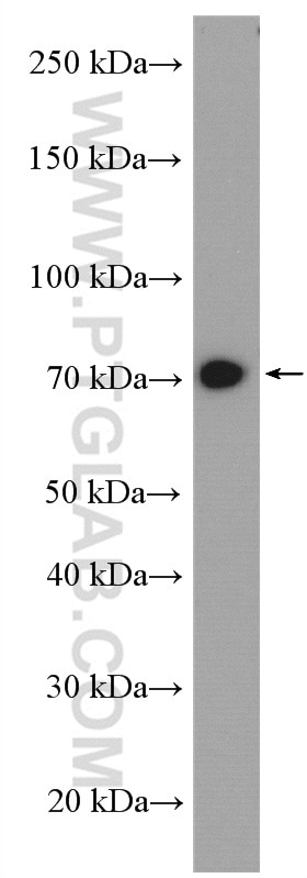 Western Blot (WB) analysis of Caco-2 cells using ACSS1 Polyclonal antibody (17138-1-AP)