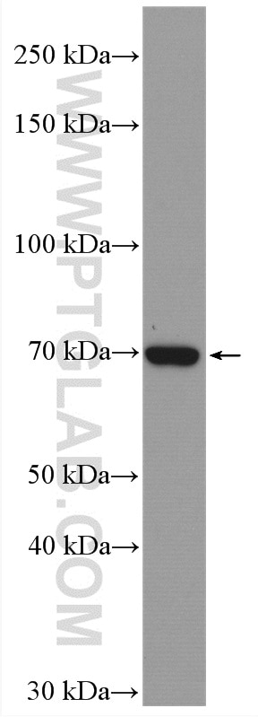 Western Blot (WB) analysis of Caco-2 cells using ACSS1 Polyclonal antibody (17138-1-AP)