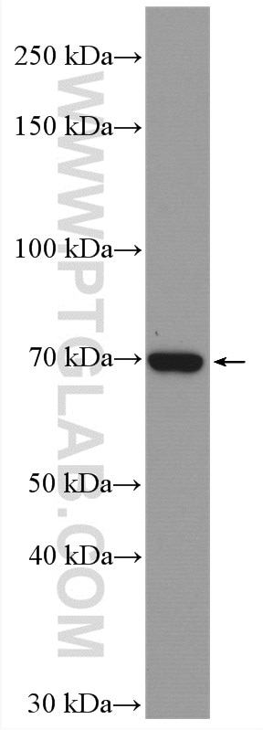 WB analysis of Caco-2 using 17138-1-AP