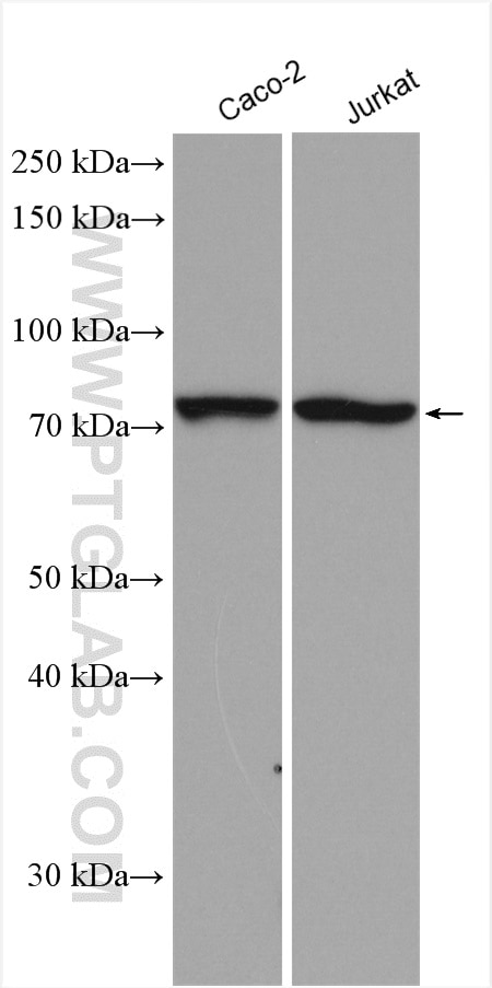 Western Blot (WB) analysis of various lysates using ACSS1 Polyclonal antibody (17138-1-AP)