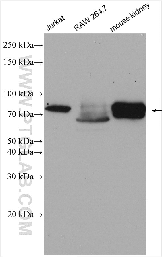 Western Blot (WB) analysis of various lysates using ACSS1 Polyclonal antibody (17138-1-AP)