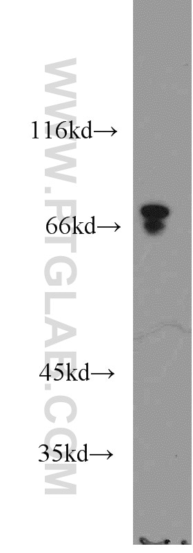 Western Blot (WB) analysis of mouse kidney tissue using ACSS1 Polyclonal antibody (17138-1-AP)