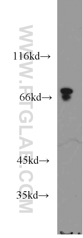 WB analysis of mouse kidney using 17138-1-AP