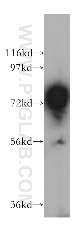 WB analysis of mouse kidney using 17138-1-AP