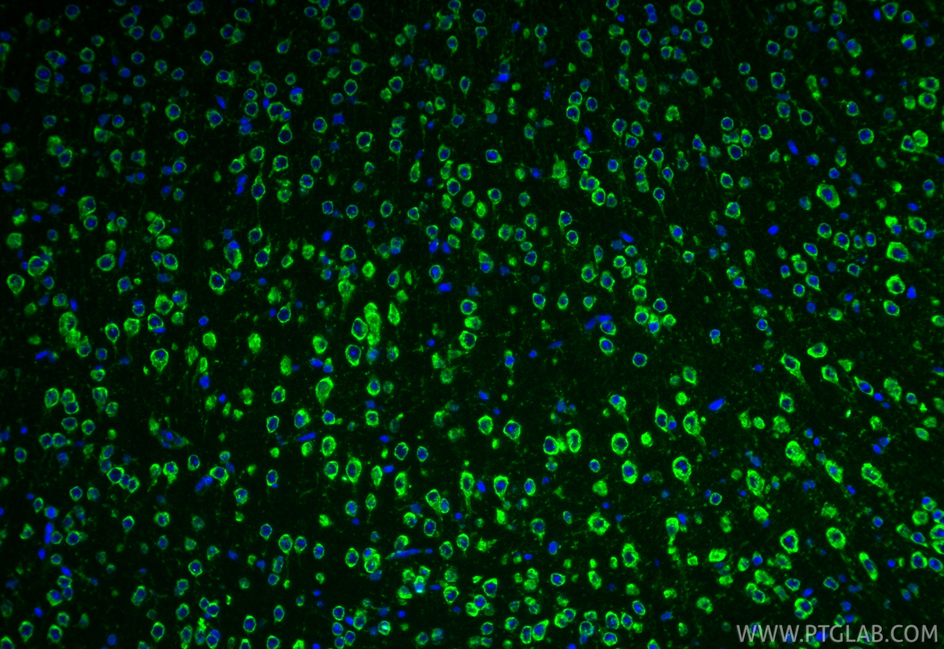 IF Staining of mouse brain using 68608-1-Ig Immunofluorescence (IF) / fluorescent staining of mouse brain tissue using ACSS1 Monoclonal antibody (68608-1-Ig)