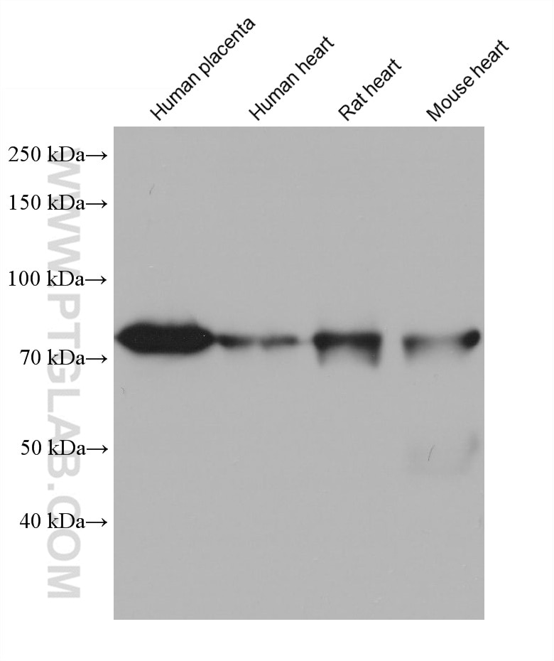 Western Blot (WB) analysis of various lysates using ACSS1 Monoclonal antibody (68608-1-Ig)