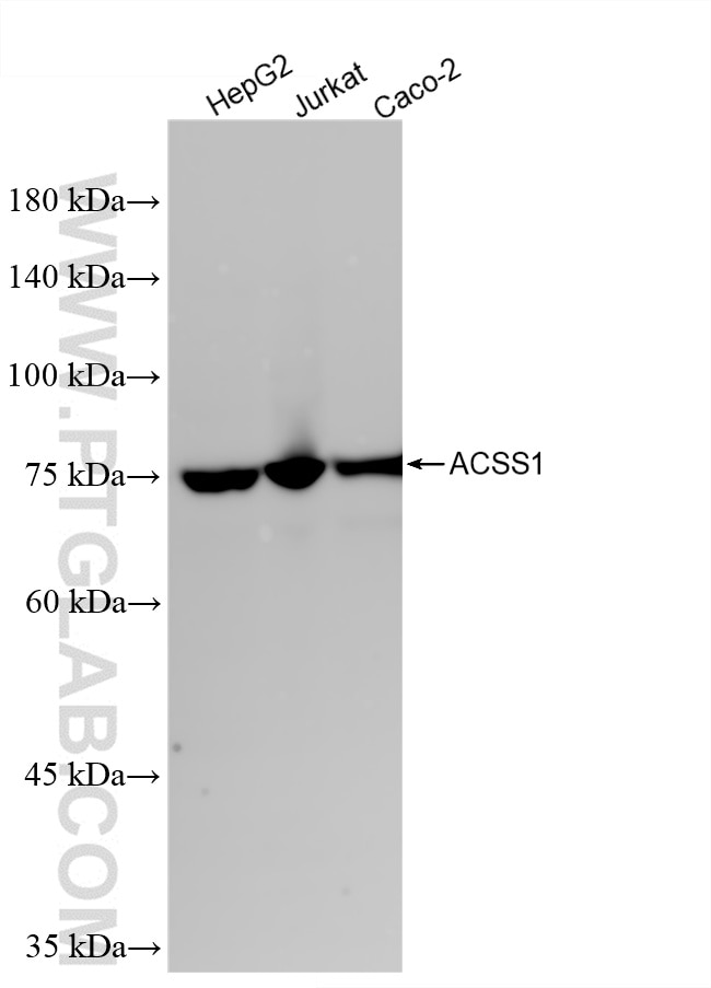 Western Blot (WB) analysis of various lysates using ACSS1 Recombinant antibody (85102-4-RR)