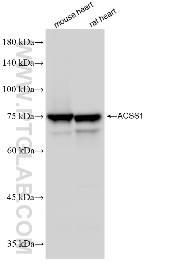 ACSS1