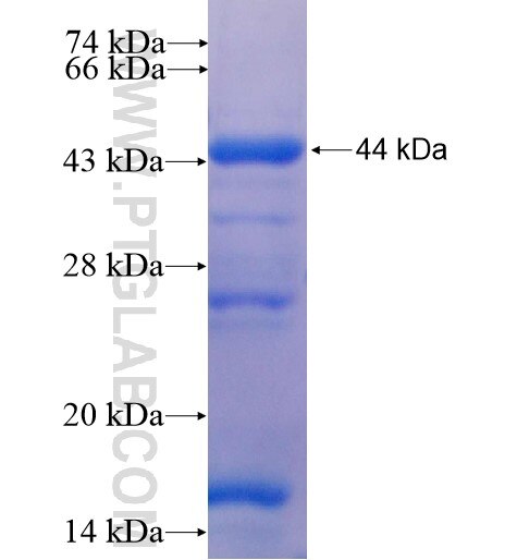 ACSS1 fusion protein Ag10853 SDS-PAGE