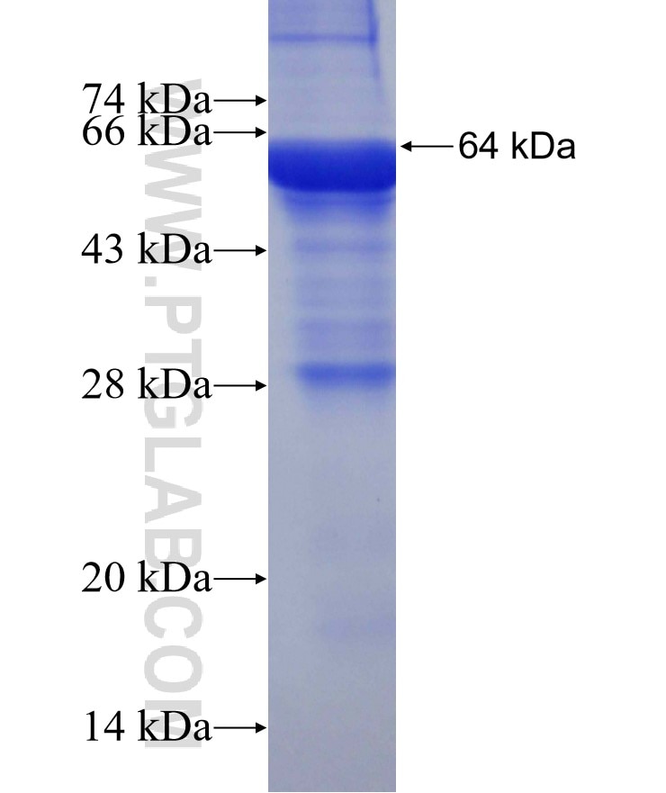 ACSS1 fusion protein Ag10896 SDS-PAGE