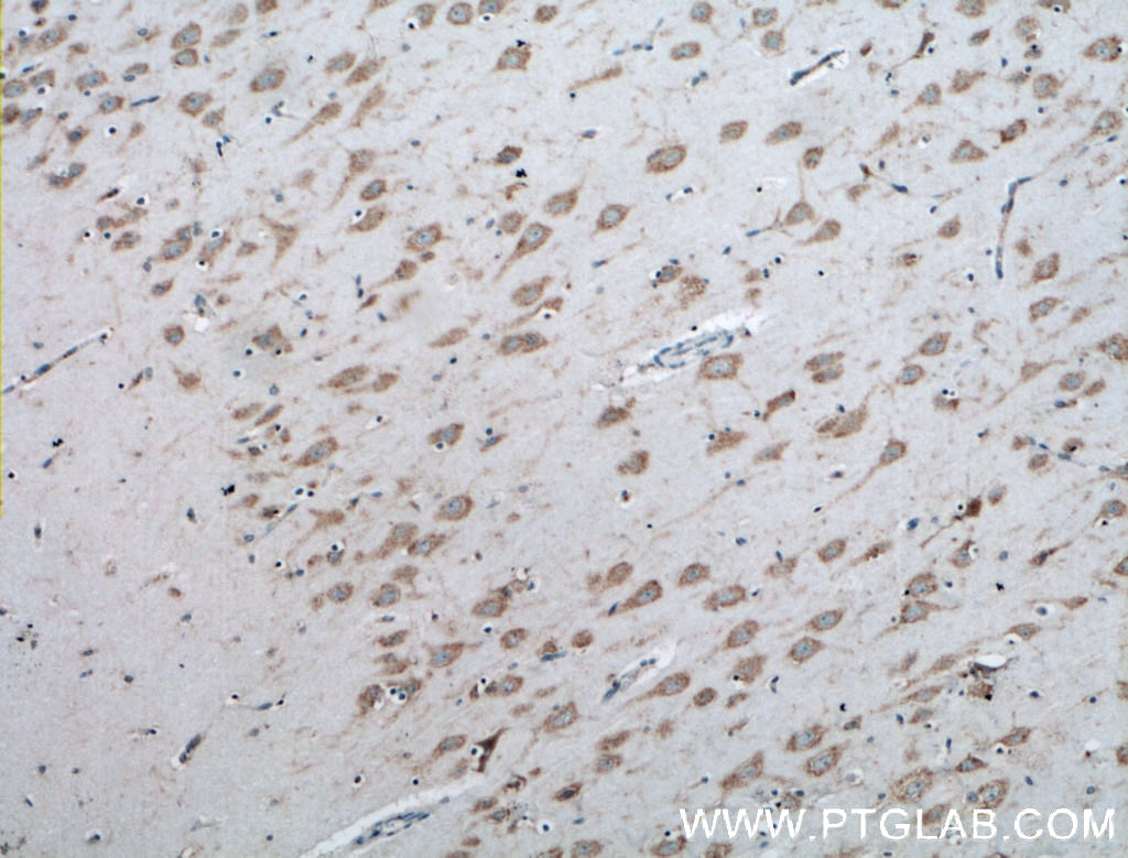 Immunohistochemistry (IHC) staining of human brain tissue using ACSS2 Polyclonal antibody (16087-1-AP)