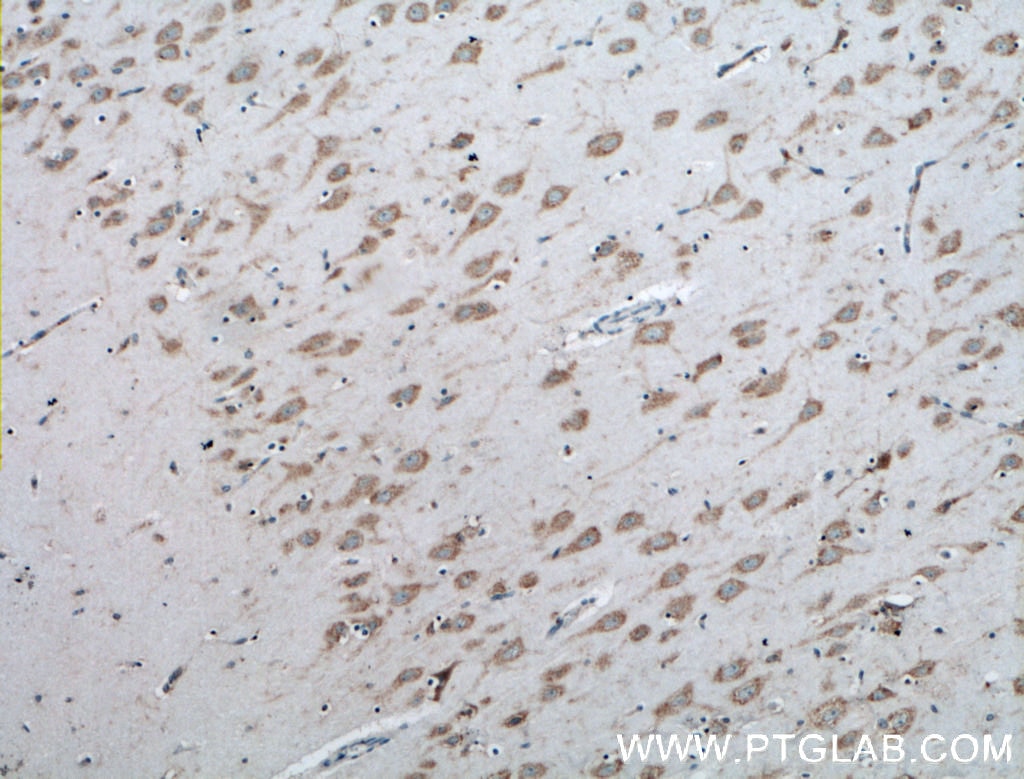 Immunohistochemistry (IHC) staining of human brain tissue using ACSS2 Polyclonal antibody (16087-1-AP)