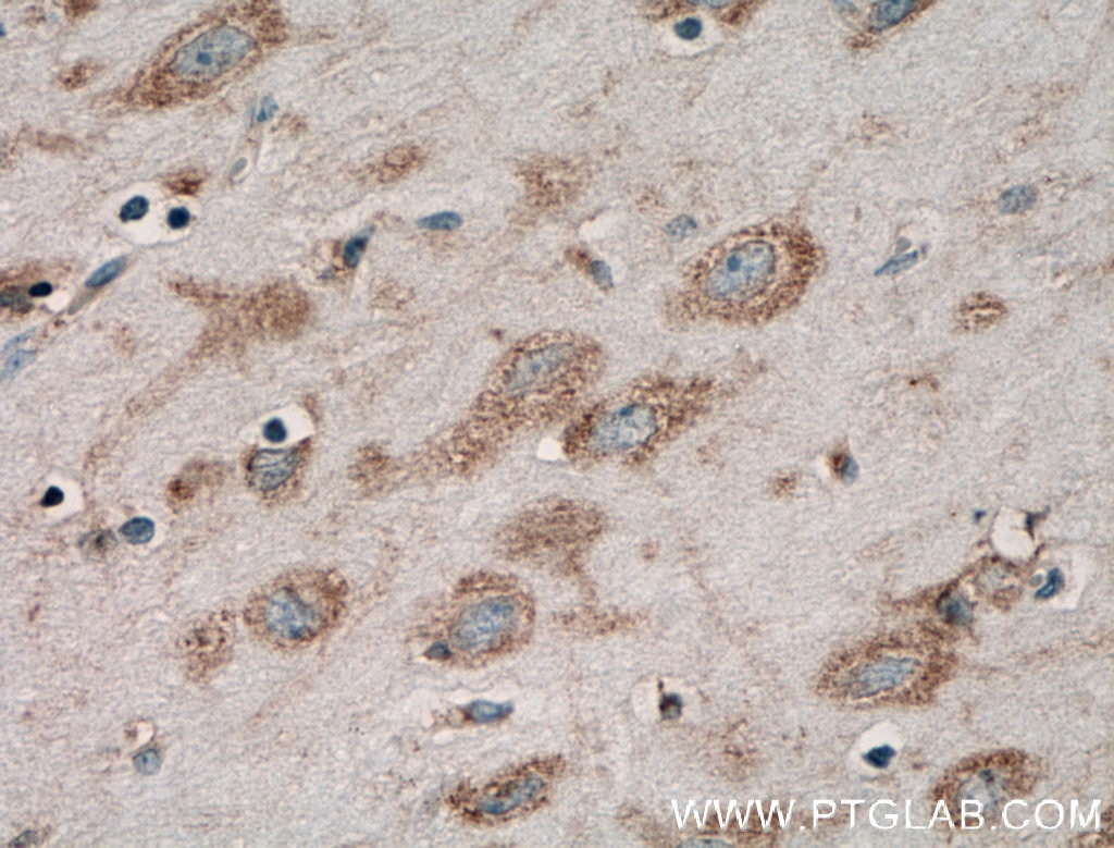 Immunohistochemistry (IHC) staining of human brain tissue using ACSS2 Polyclonal antibody (16087-1-AP)
