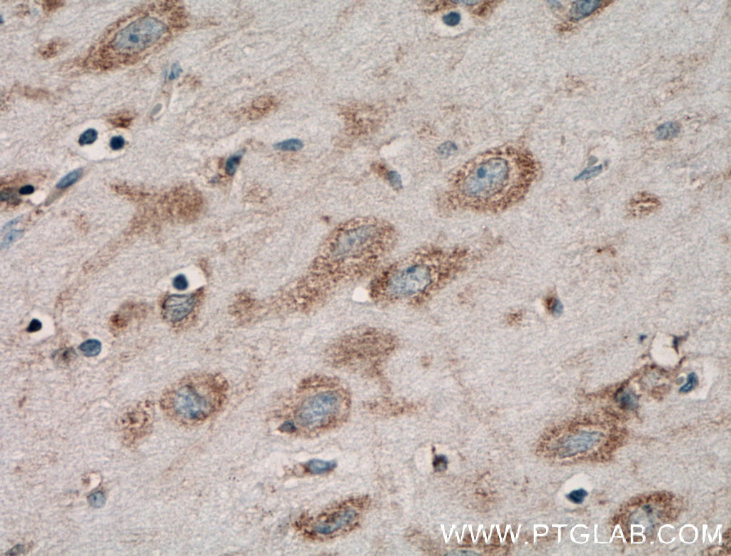 IHC staining of human brain using 16087-1-AP