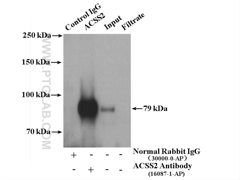 Immunoprecipitation (IP) experiment of HepG2 cells using ACSS2 Polyclonal antibody (16087-1-AP)