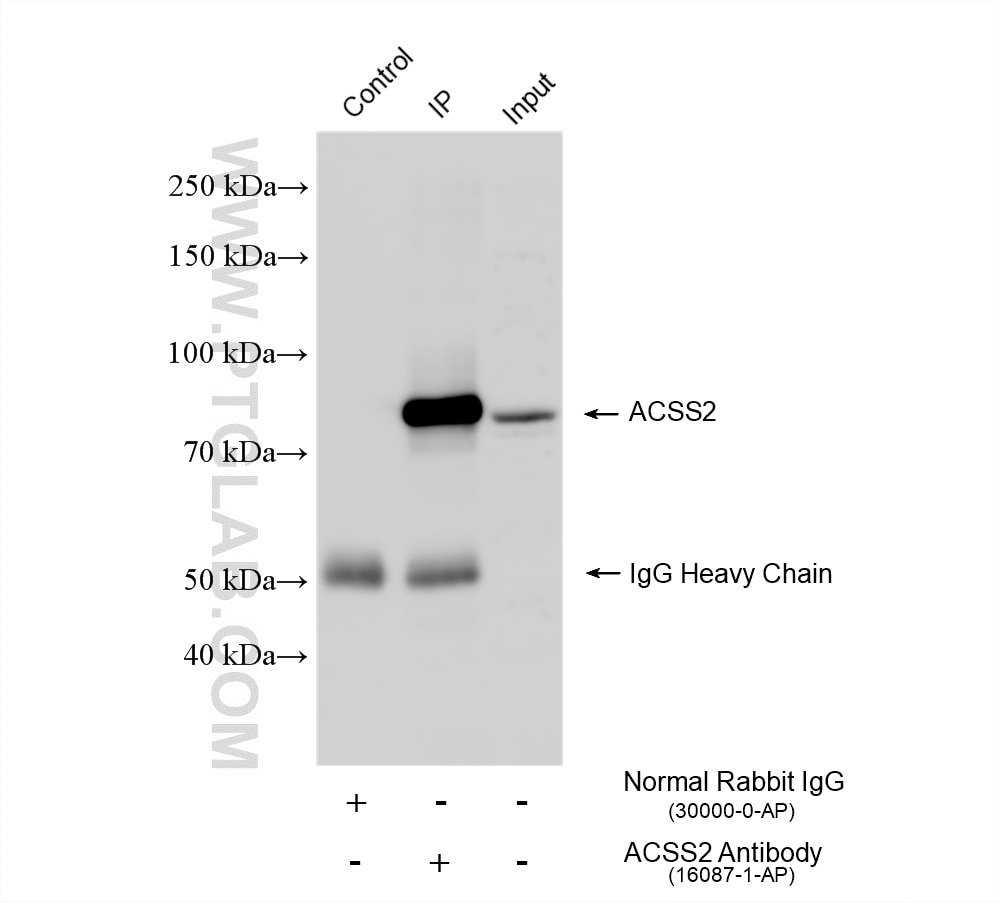 Immunoprecipitation (IP) experiment of HepG2 cells using ACSS2 Polyclonal antibody (16087-1-AP)