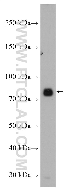 ACSS2