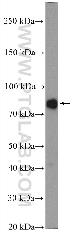 Western Blot (WB) analysis of mouse liver tissue using ACSS2 Polyclonal antibody (16087-1-AP)