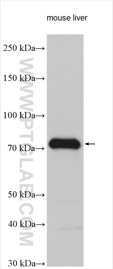 Western Blot (WB) analysis of various lysates using ACSS2 Polyclonal antibody (16087-1-AP)