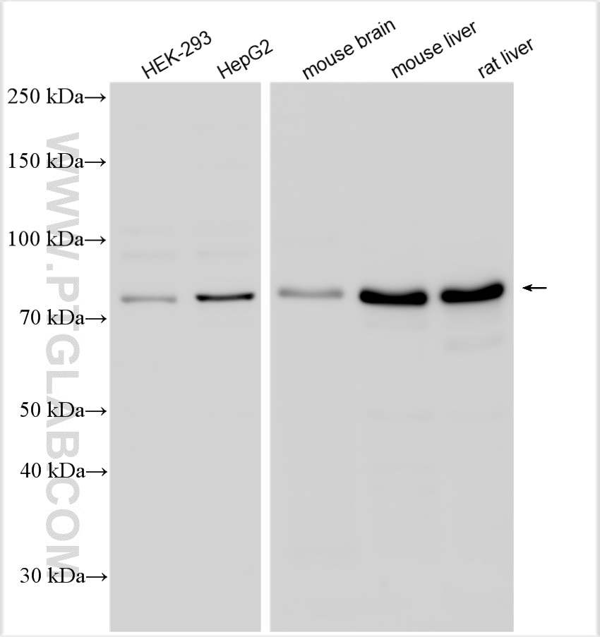 Western Blot (WB) analysis of various lysates using ACSS2 Polyclonal antibody (16087-1-AP)
