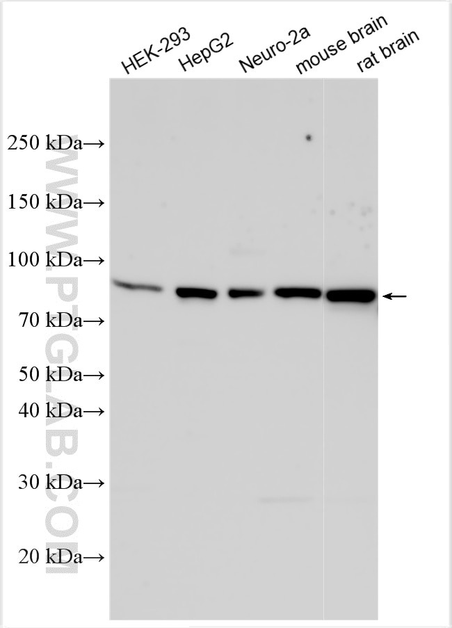 Western Blot (WB) analysis of various lysates using ACSS2 Polyclonal antibody (16087-1-AP)