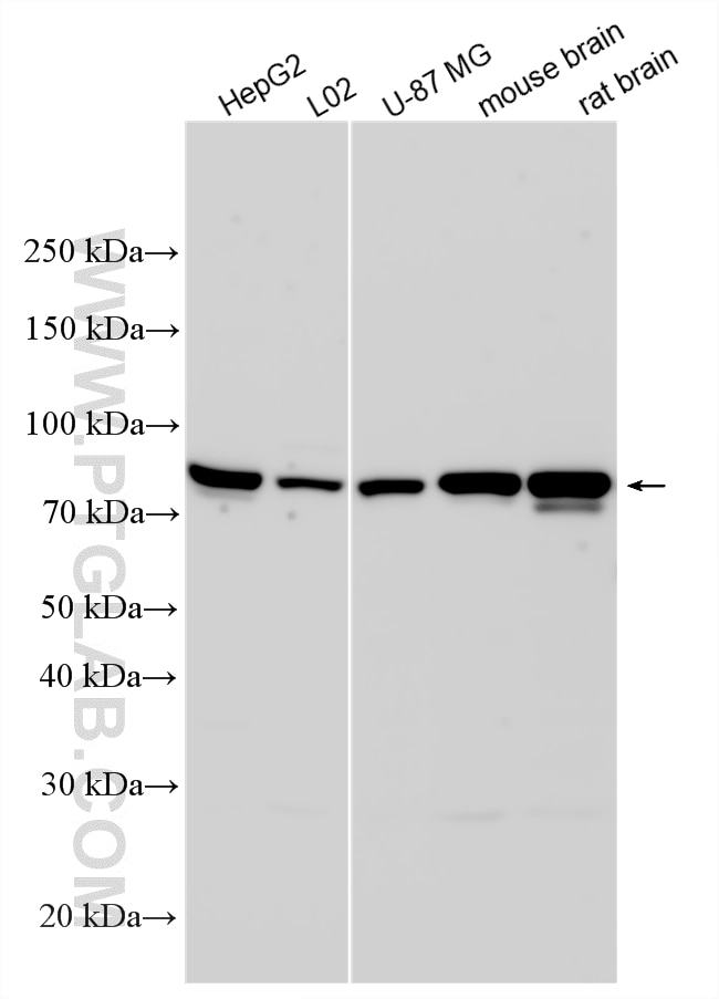 Western Blot (WB) analysis of various lysates using ACSS2 Polyclonal antibody (16087-1-AP)