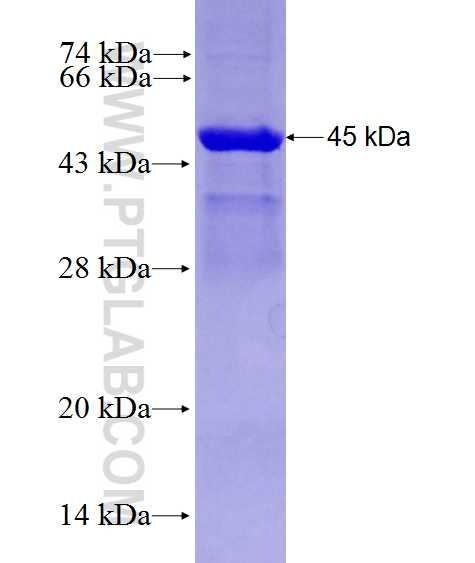 ACSS2 fusion protein Ag28140 SDS-PAGE