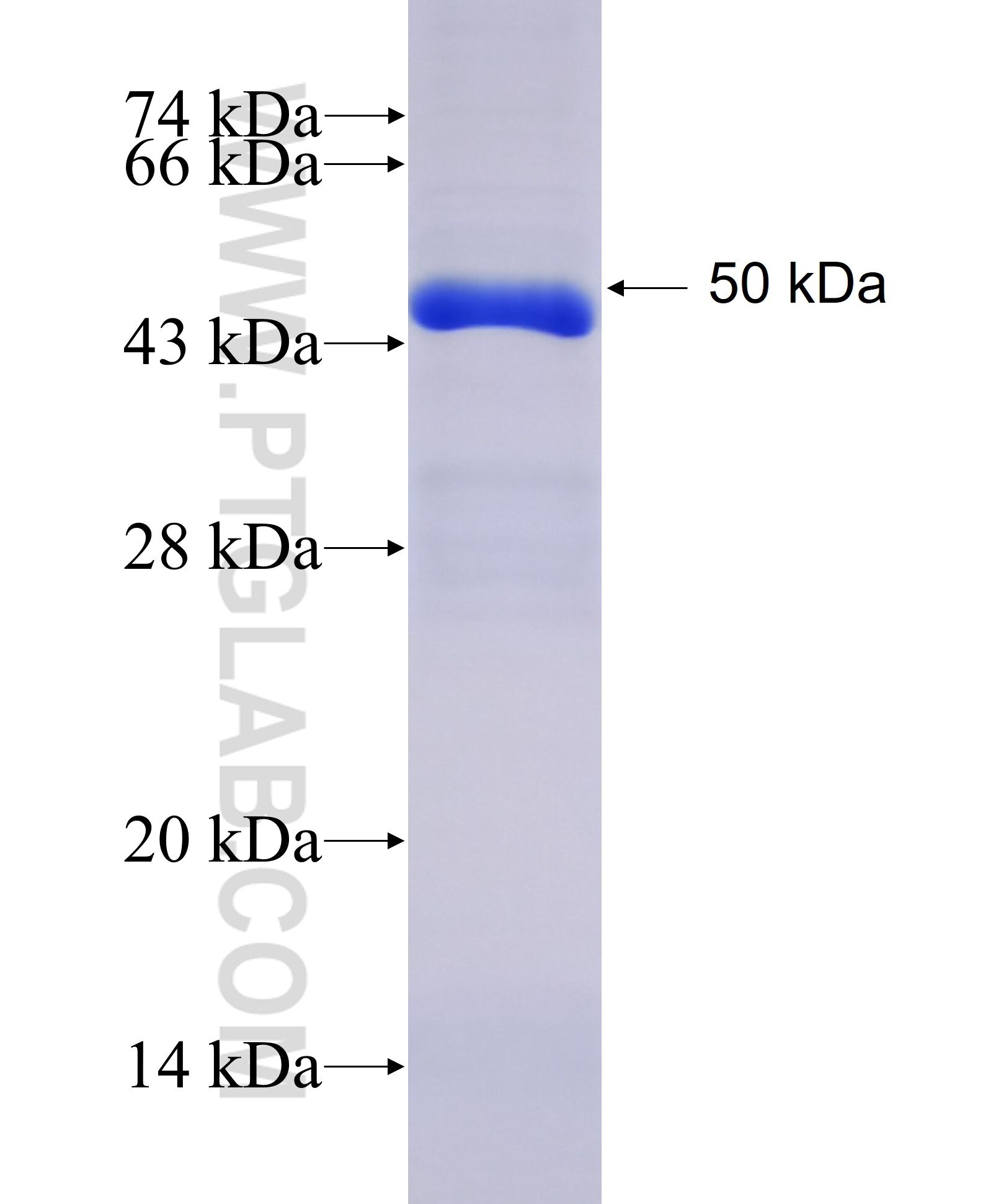 ACSS2 fusion protein Ag28140 SDS-PAGE