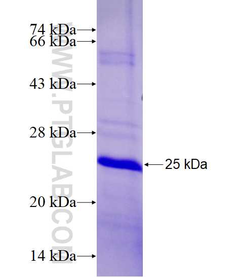ACSS2 fusion protein Ag28304 SDS-PAGE