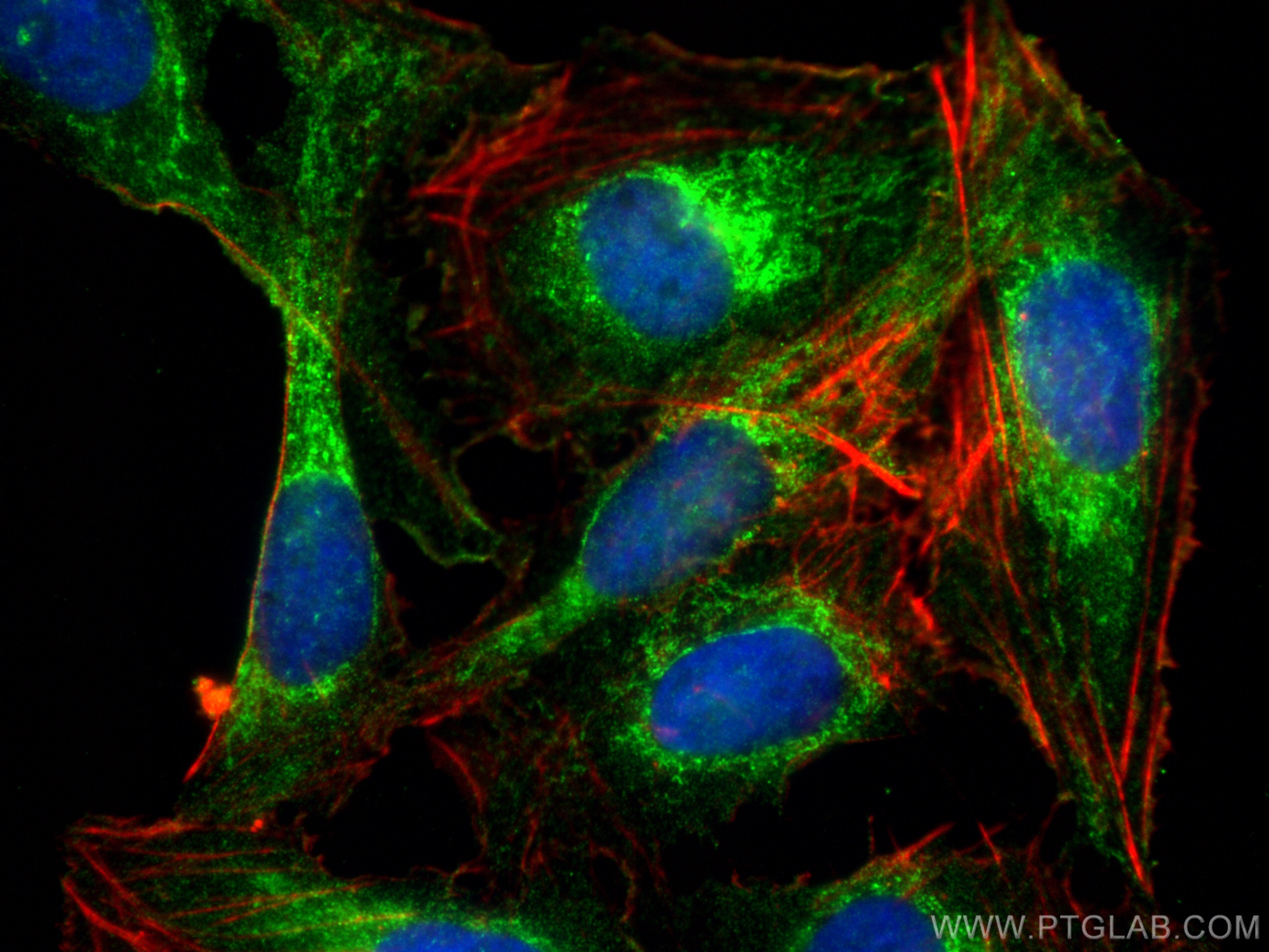 Immunofluorescence (IF) / fluorescent staining of U2OS cells using ACSS3 Polyclonal antibody (16204-1-AP)