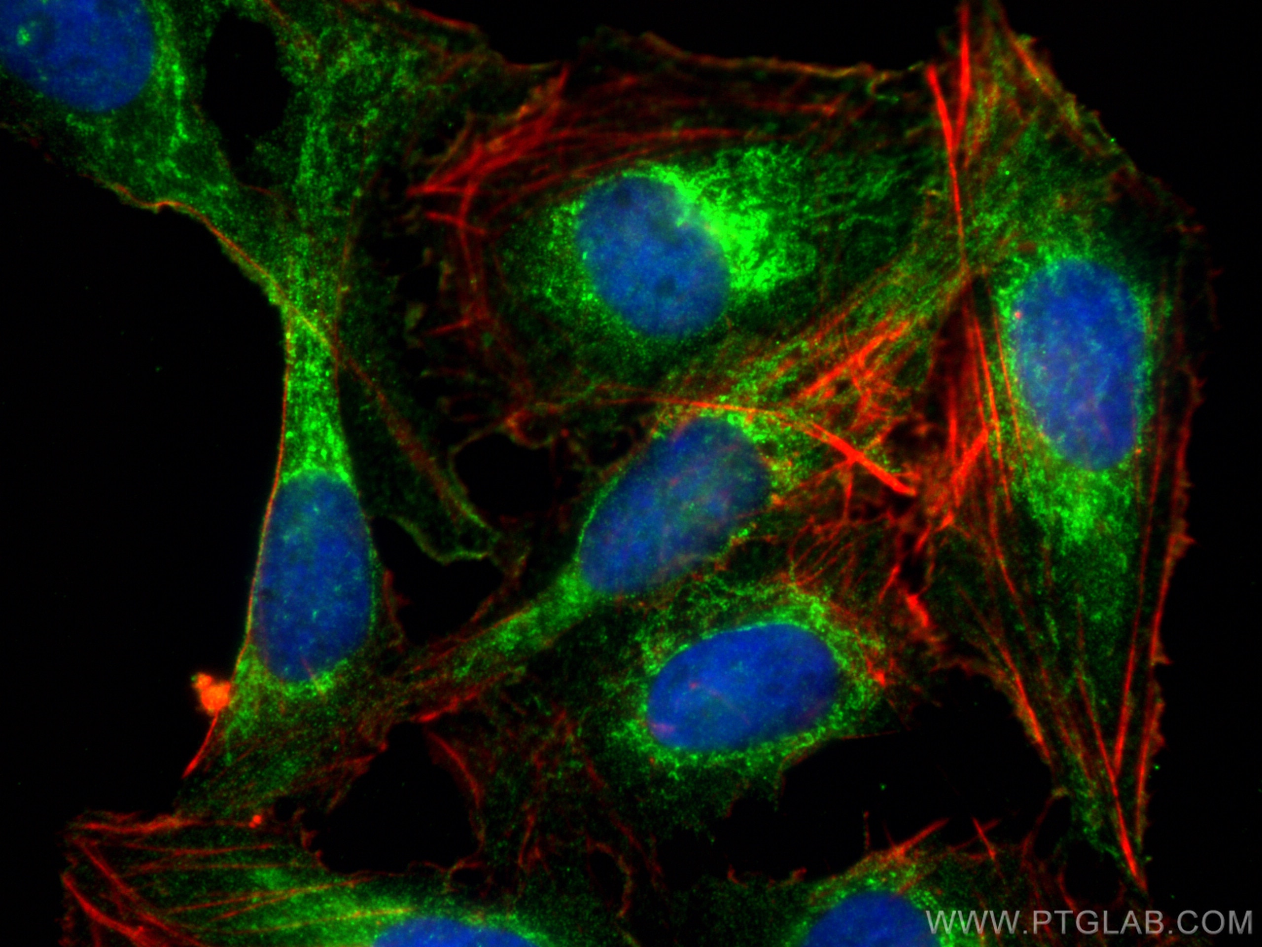 IF Staining of U2OS using 16204-1-AP