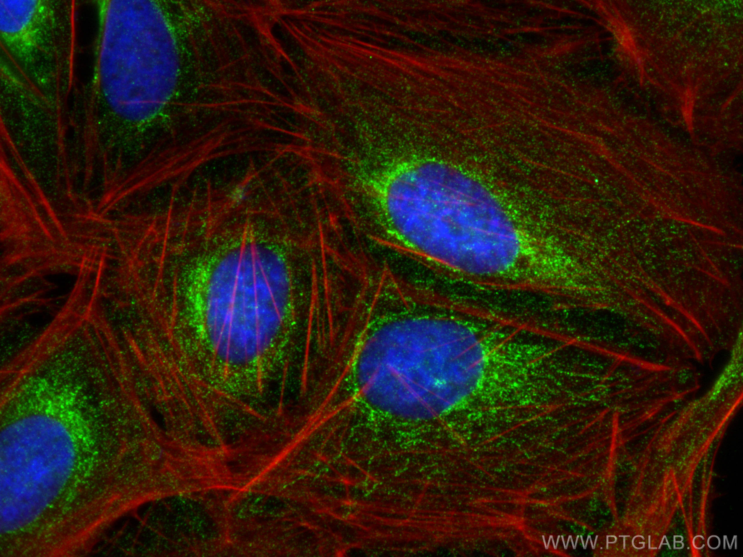 Immunofluorescence (IF) / fluorescent staining of U2OS cells using ACSS3 Polyclonal antibody (16204-1-AP)