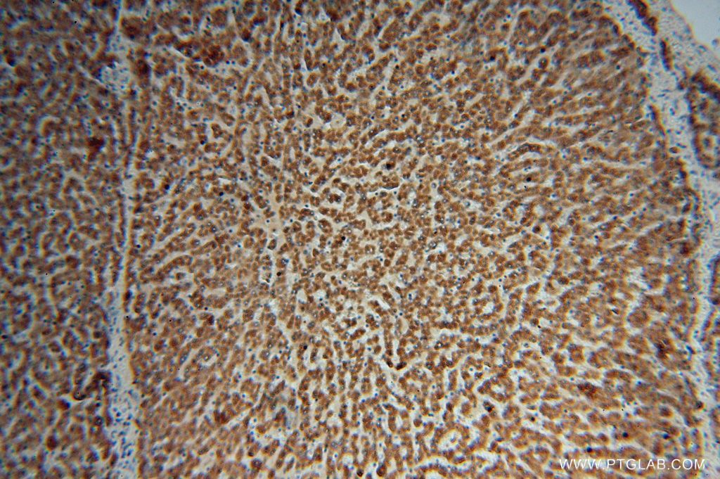 Immunohistochemistry (IHC) staining of human liver tissue using ACSS3 Polyclonal antibody (16204-1-AP)