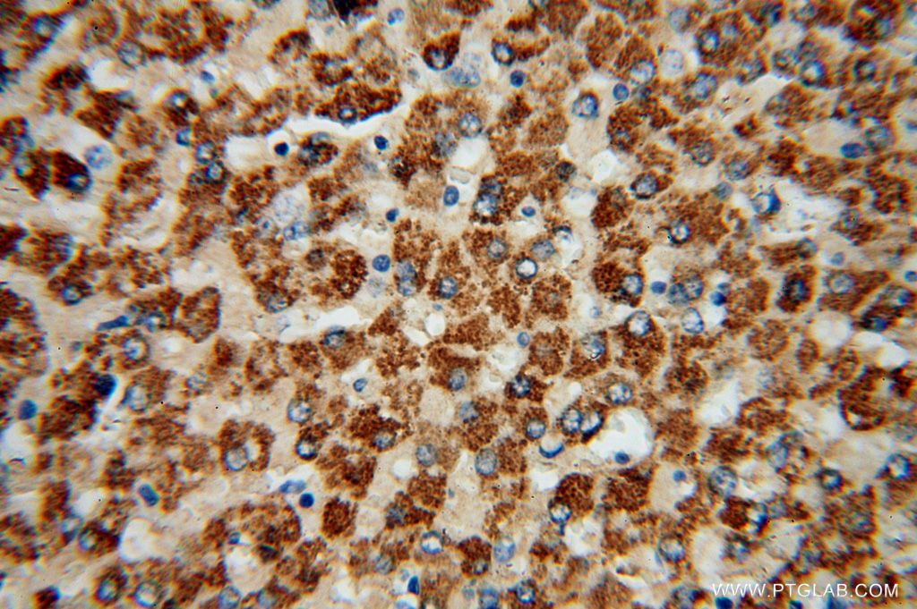 Immunohistochemistry (IHC) staining of human liver tissue using ACSS3 Polyclonal antibody (16204-1-AP)