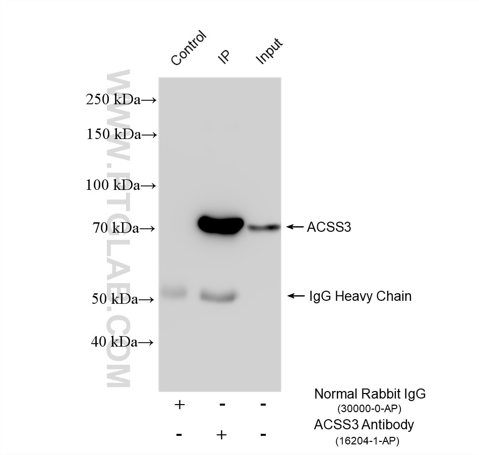 Immunoprecipitation (IP) experiment of mouse liver tissue using ACSS3 Polyclonal antibody (16204-1-AP)