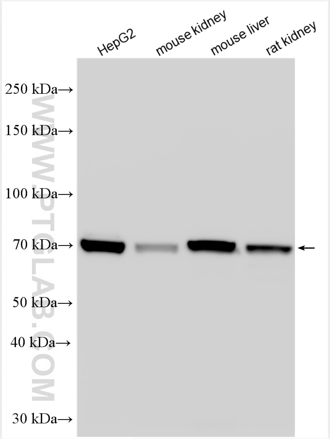 Western Blot (WB) analysis of various lysates using ACSS3 Polyclonal antibody (16204-1-AP)