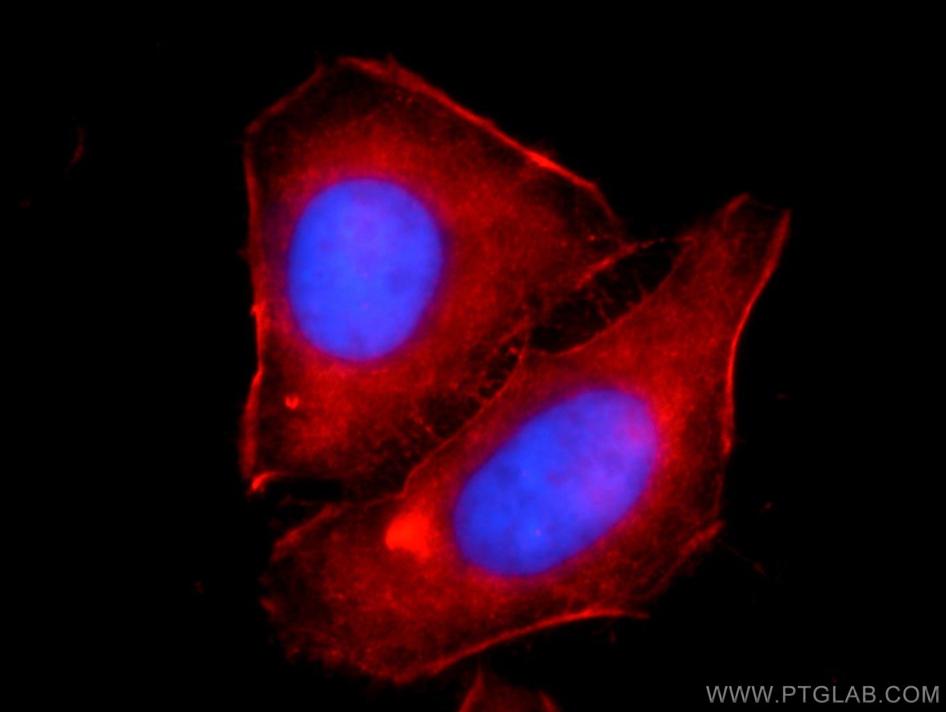 Immunofluorescence (IF) / fluorescent staining of HepG2 cells using Alpha Actin Polyclonal antibody (23660-1-AP)